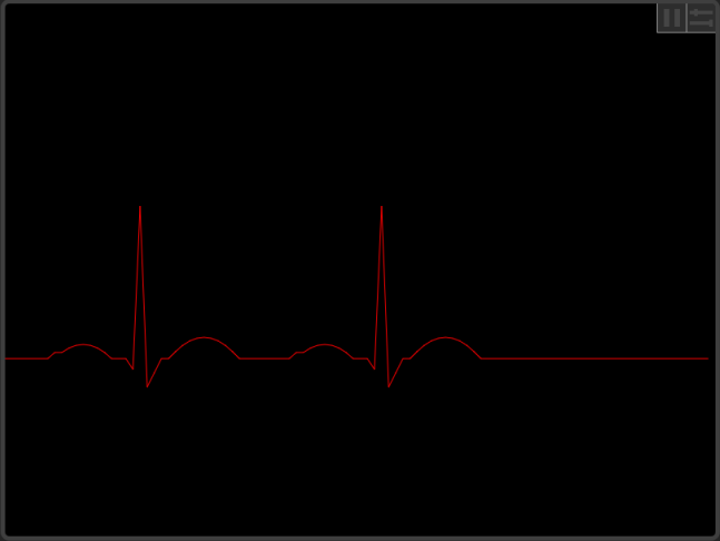 Heartrate monitor
